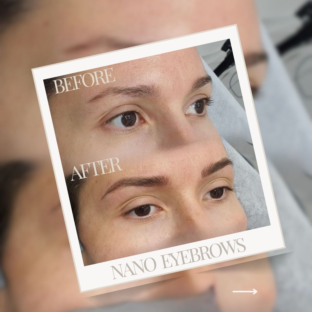 Μόνιμο Μακιγιάζ zoi daouka 1080x1080-12 Before-After