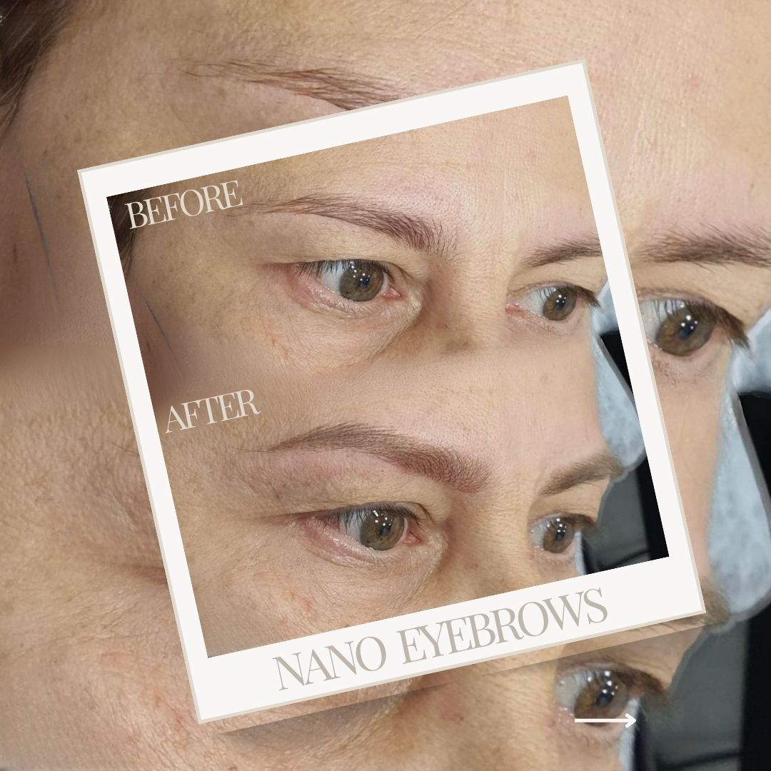 Μόνιμο Μακιγιάζ zoi daouka 1080x1080-13 Before-After