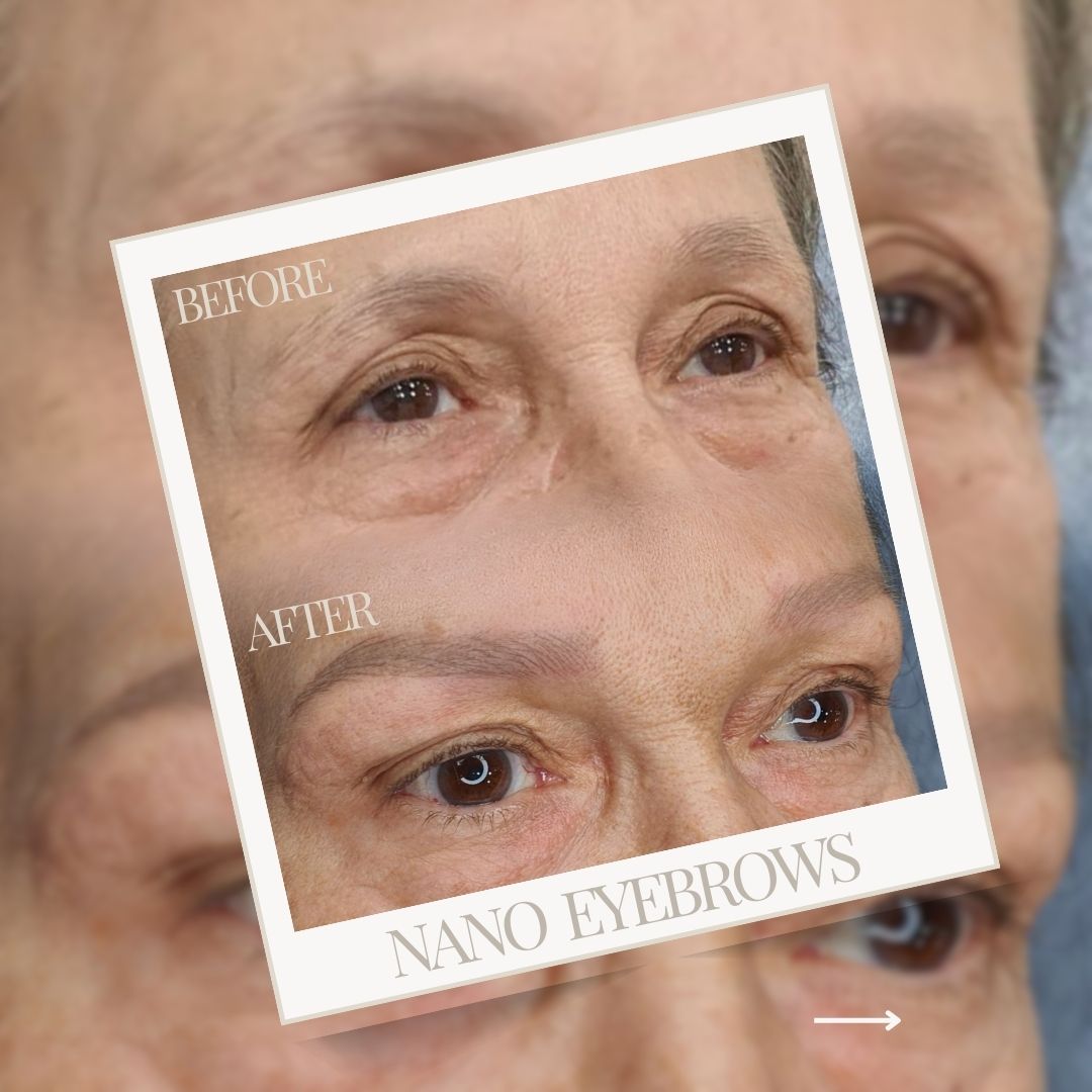 Μόνιμο Μακιγιάζ zoi daouka 1080x1080-16 Before-After